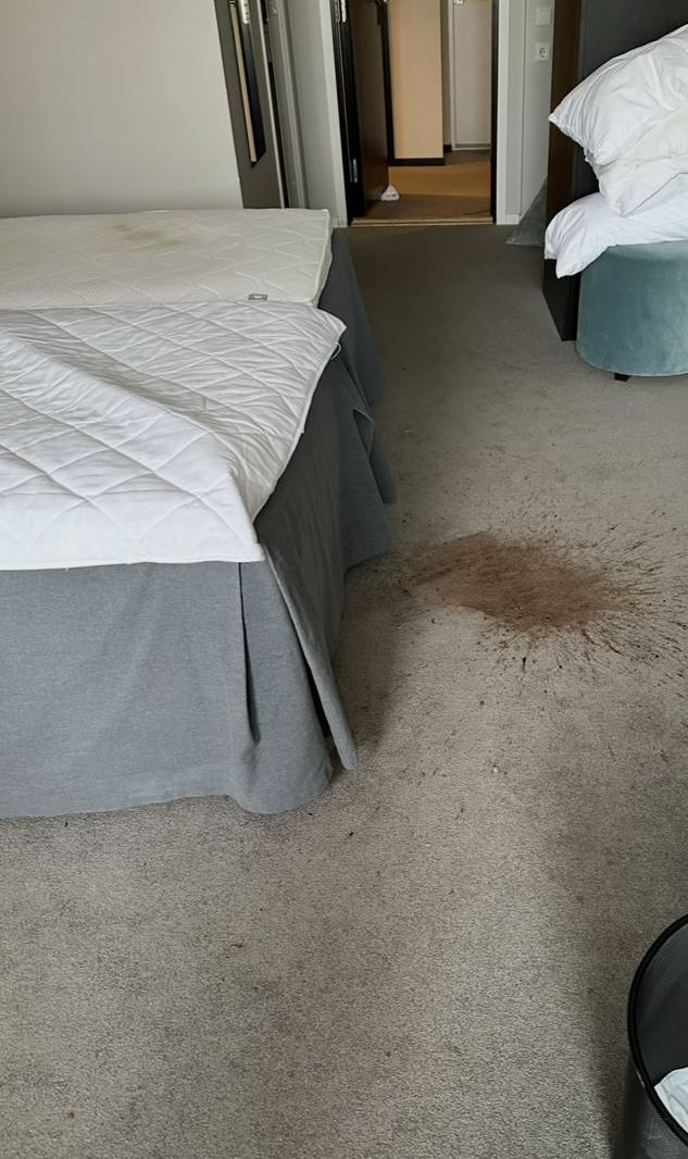 Före: hotellrum